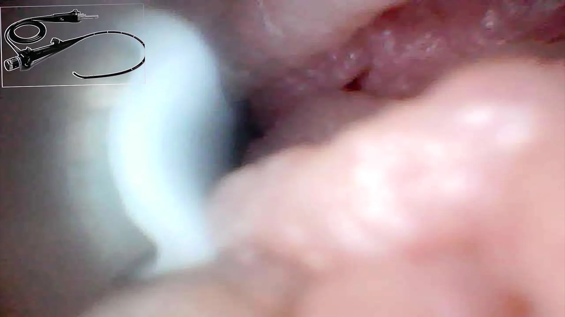 Exclusive: Camera Goes Inside – We Found My G-Spot and Captured 5 Orgasms!