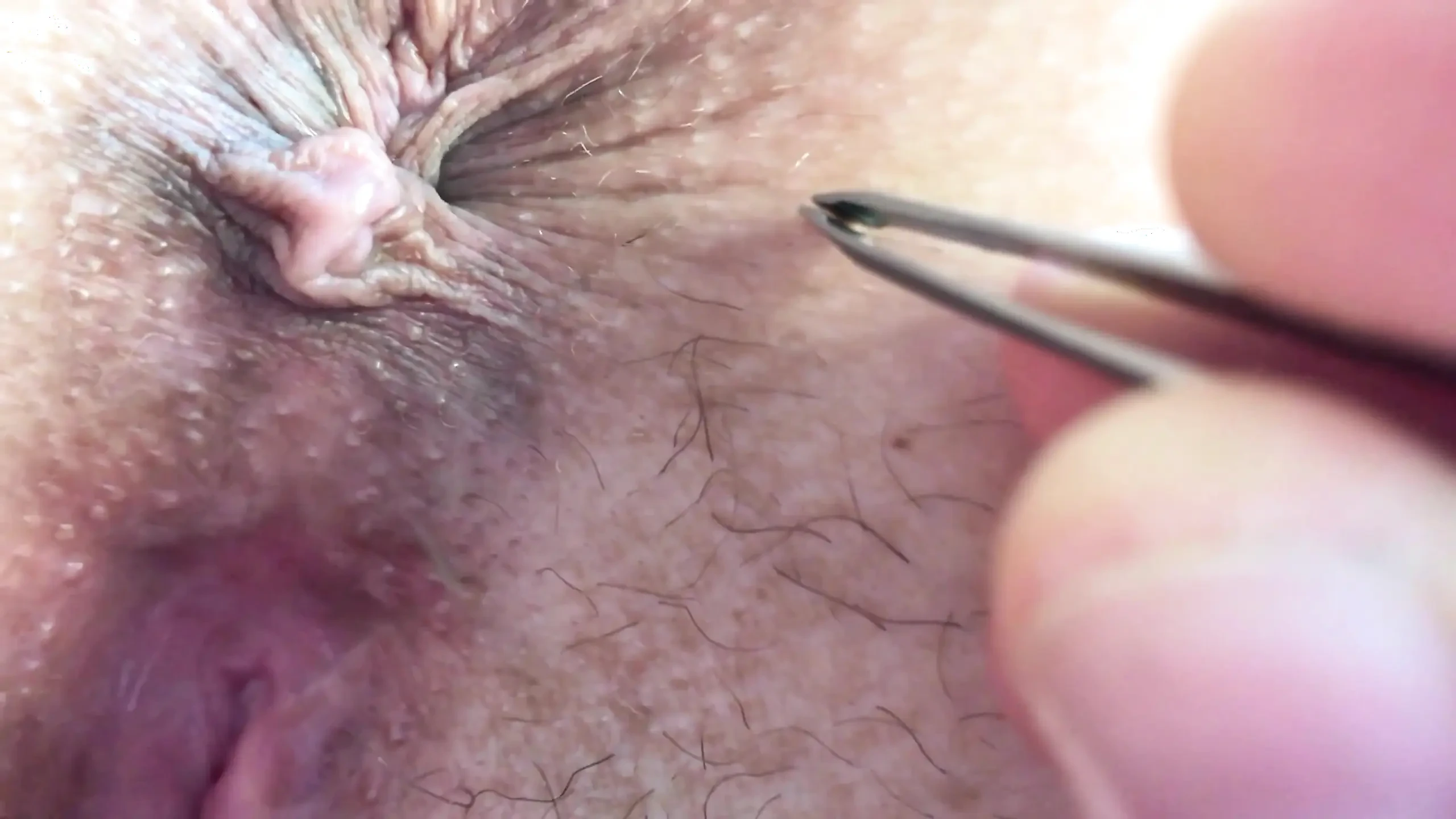 This is what happens when you ask your husband to help you remove the hair around the asshole and in the bikini area…