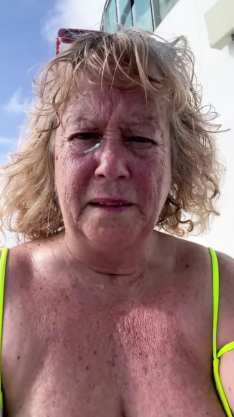 Putting Sunscreen on Every Last Freckle